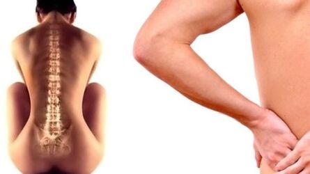 Dolor de espalda en la región lumbar. 