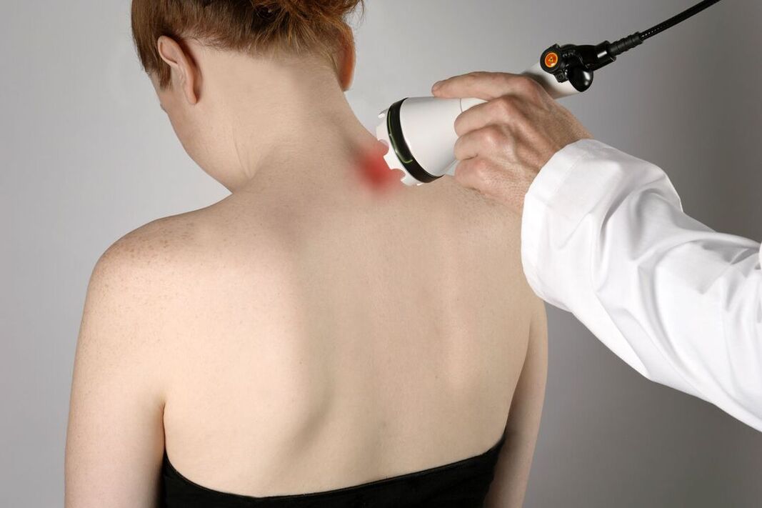 tratamiento de fisioterapia de la osteocondrosis cervical